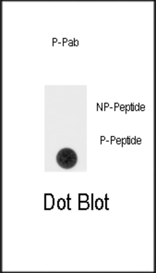 Anti-Phospho-SPRY4-pY75 0.1 mg MG