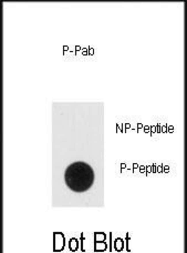 100UG ANTI-PHOSPHO-NSE-PY236 .
