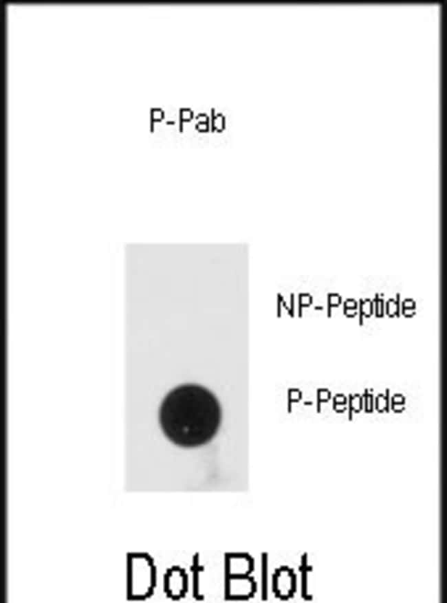 Anti-Phospho-PRKRA-pS246 0.1 mg MG