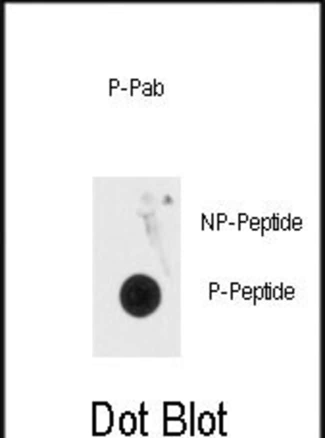 Anti-Phospho-MeCP2-pS80 0.1 mg MG