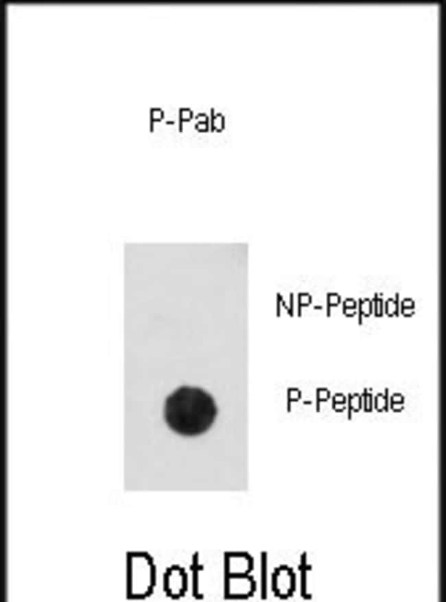 ANTI-PHOSPHO-CDK2-PT14, 0,1 MG