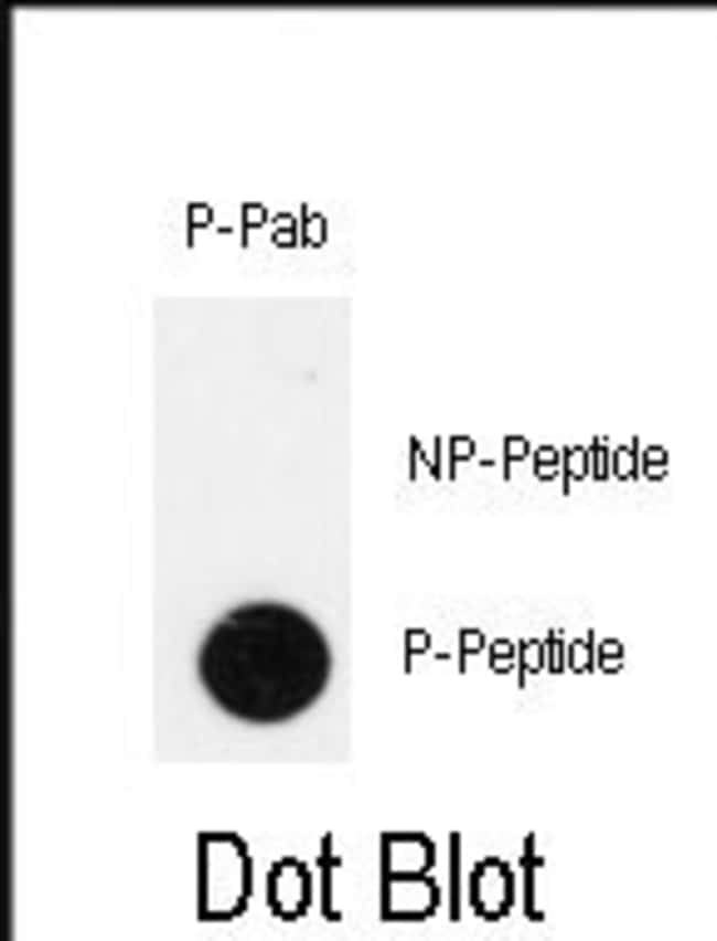 100UG ANTI-PHOSPHO-IPF-PT11 .