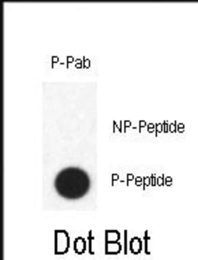 Anti-Phospho-FABP4-pY20 0.1 mg MG