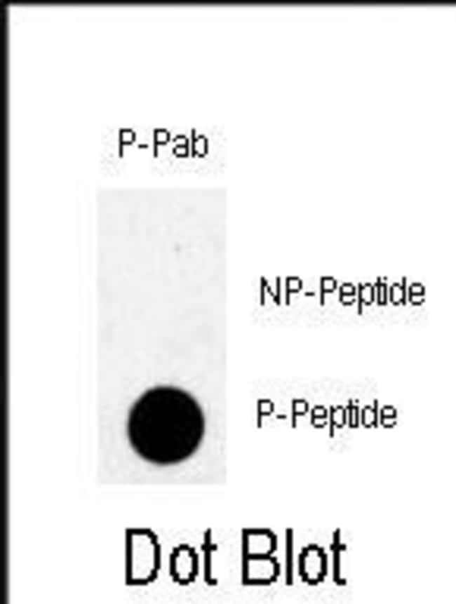 100UG ANTI-PHOSPHO-TBK-PS172 .