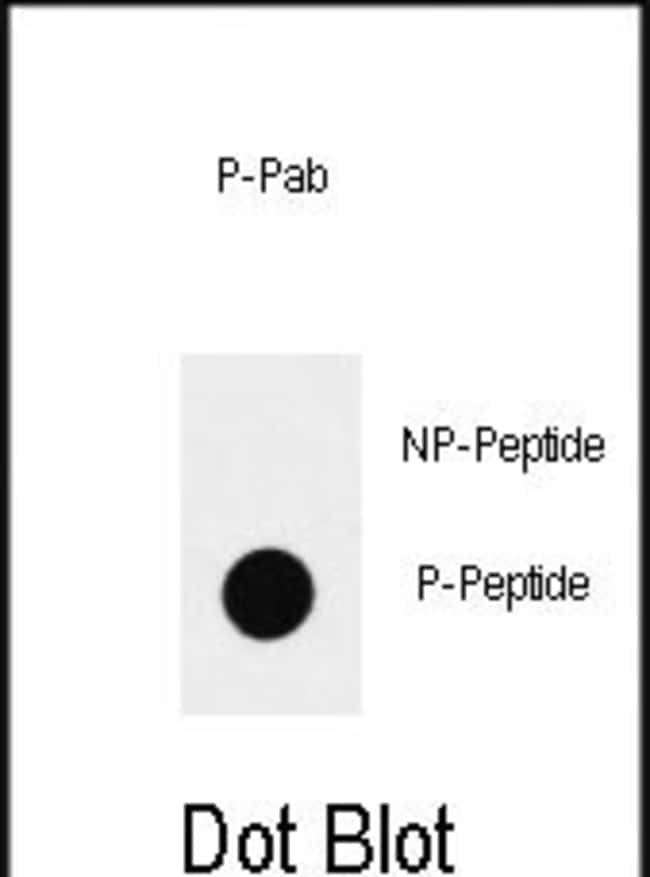 100UG ANTI-PHOSPHO-SOX2-S83 .