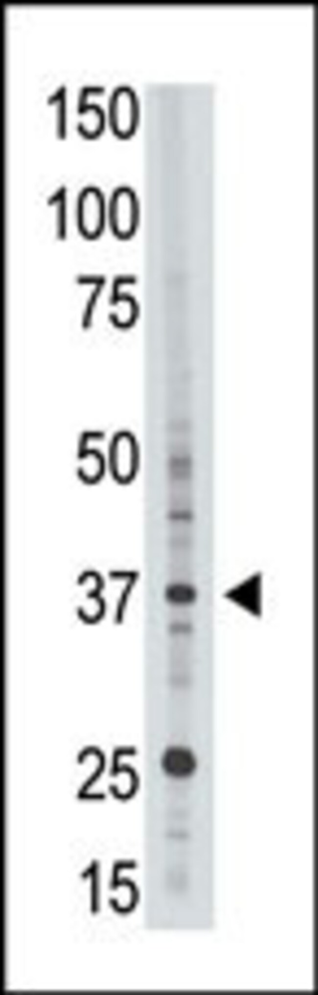 ANTI-EPR1, 0,1mg .