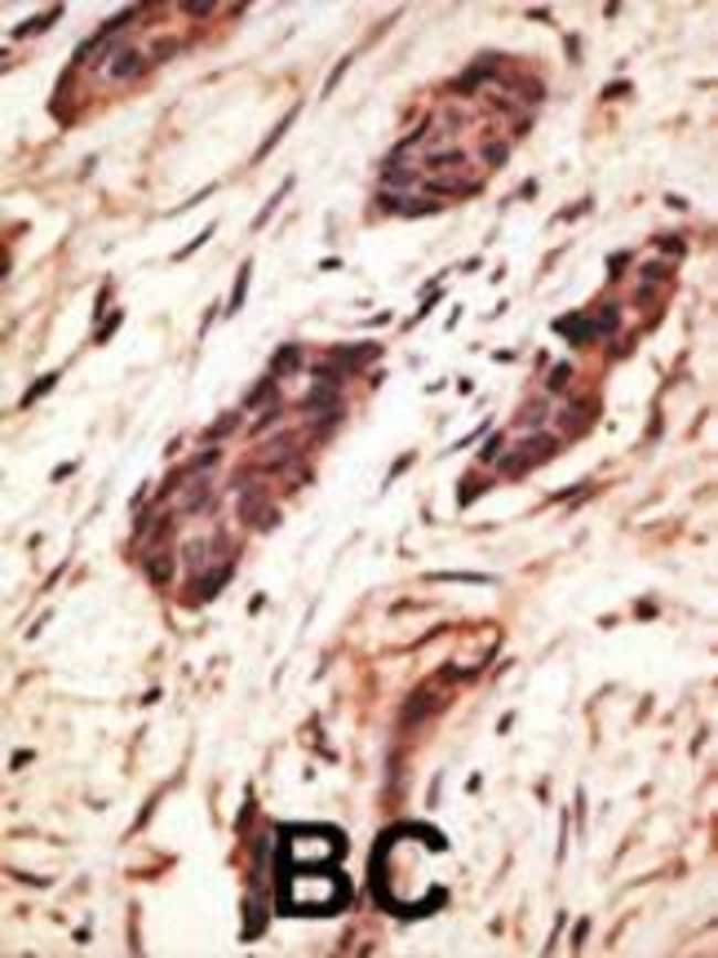 ANTI-MMP10, 0,1 MG