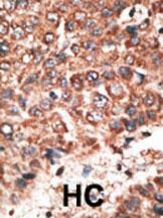 ANTI-mmP20, 0,1mg .