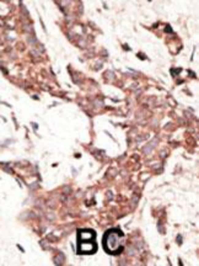 ANTI-SIRT3, 0,1 MG