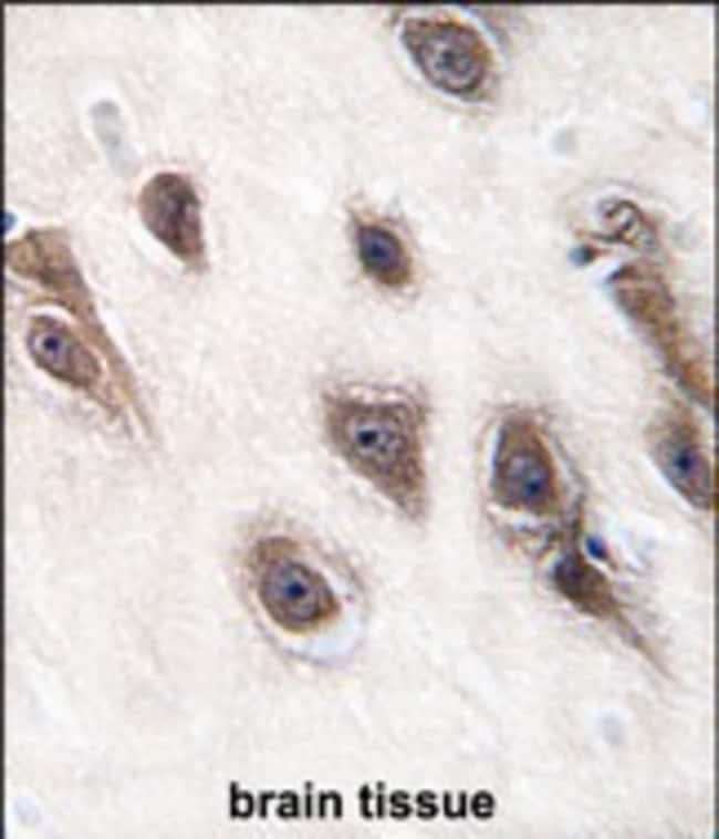 ANTI-GRB2, 0,1 MG