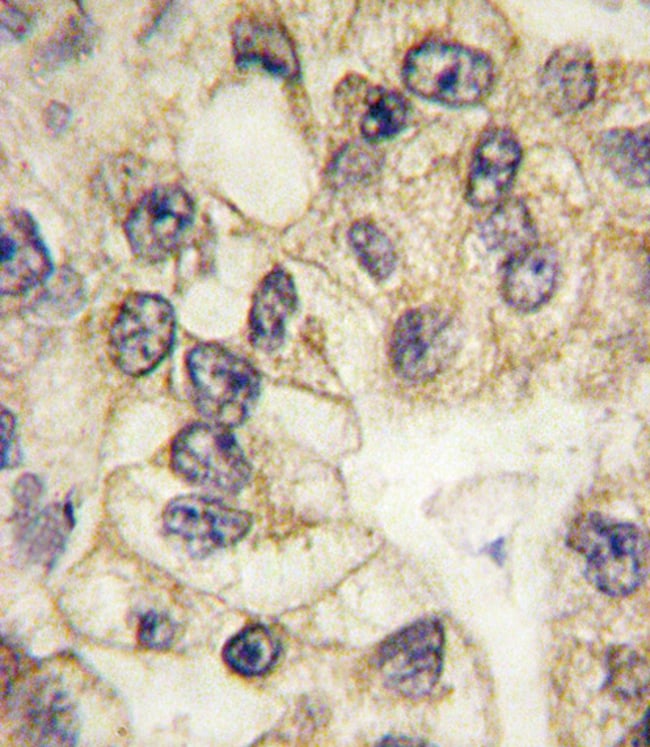 ANTI-CD14, 0,1 MG