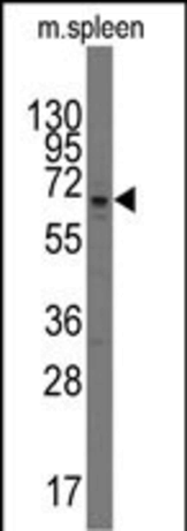 100µG ANTI-PARP3 .