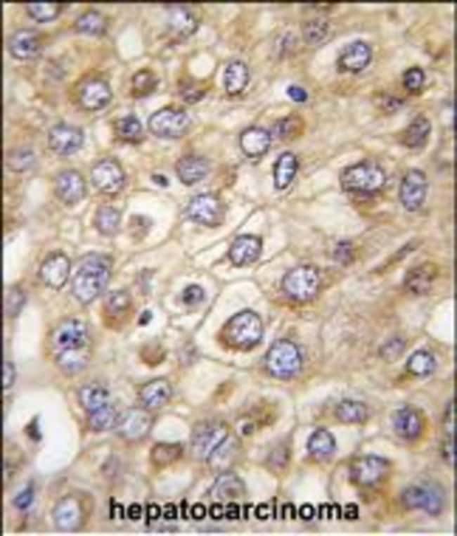 ANTI-CLAUDIN 2, 0,1 MG