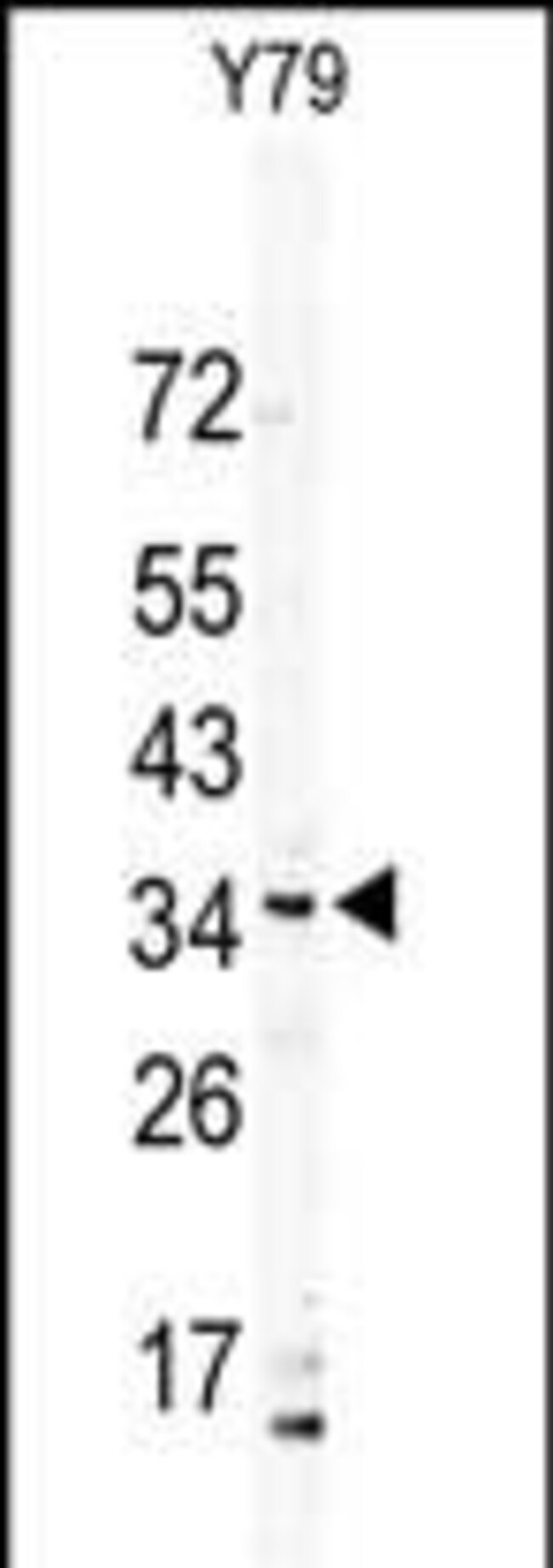 ANTI-DSCR3, 0,1 MG