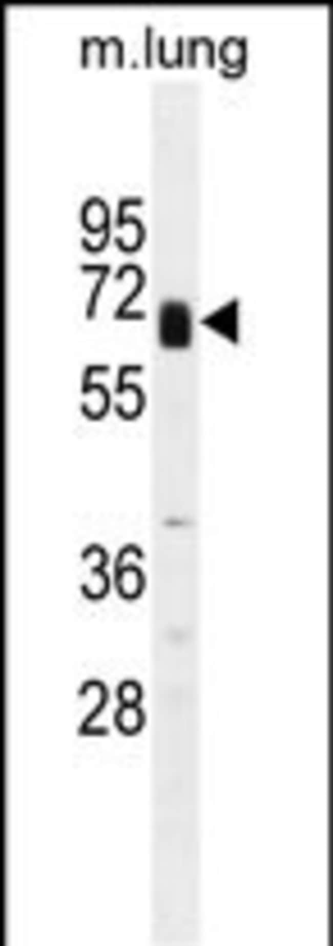 ANTI-GLYPICAN 3, 0,1mg .