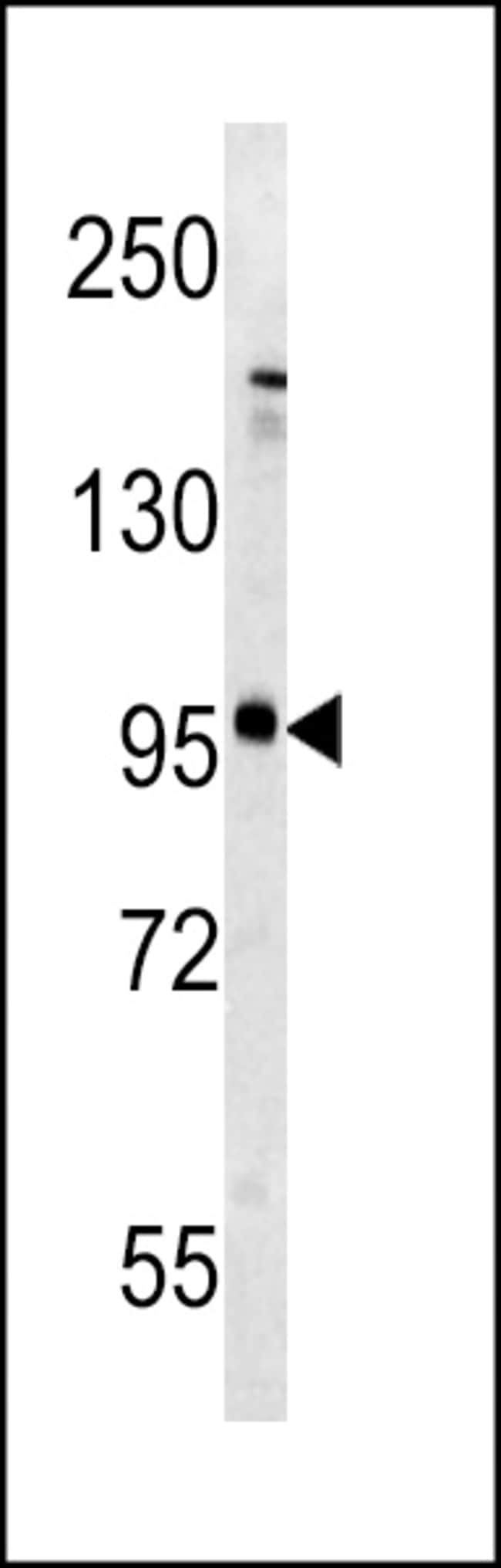 Anti-Metabotropic Glutamate Re 0.1 mg