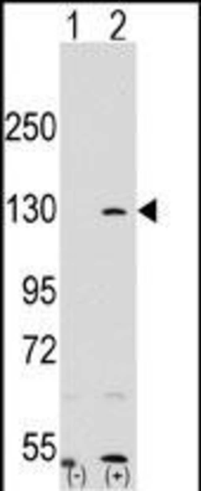 100 µG ANTI-PARP1 .