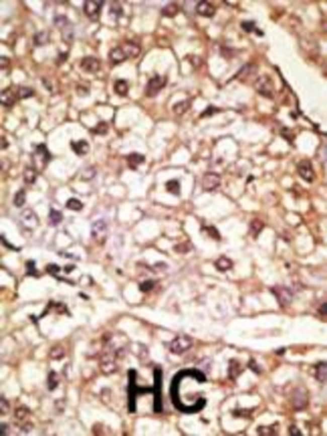 ANTI-ALPHA SYNUCLEIN, 0,1 MG