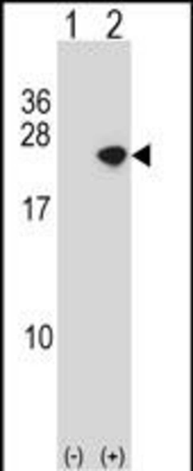 ANTI-ALPHA SYNUCLEIN, 0,1 MG