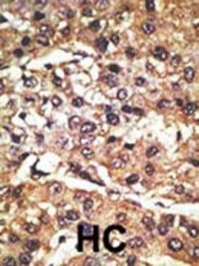 ANTI-PAEL-R, 0,1mg .