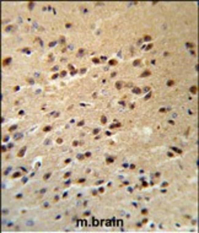 ANTI-ALS2, 0,1mg .
