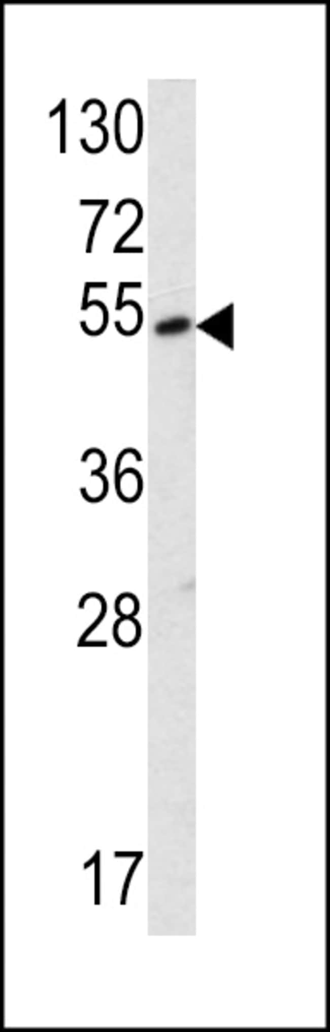 ANTI-SUV4-20H2, 0,1 MG