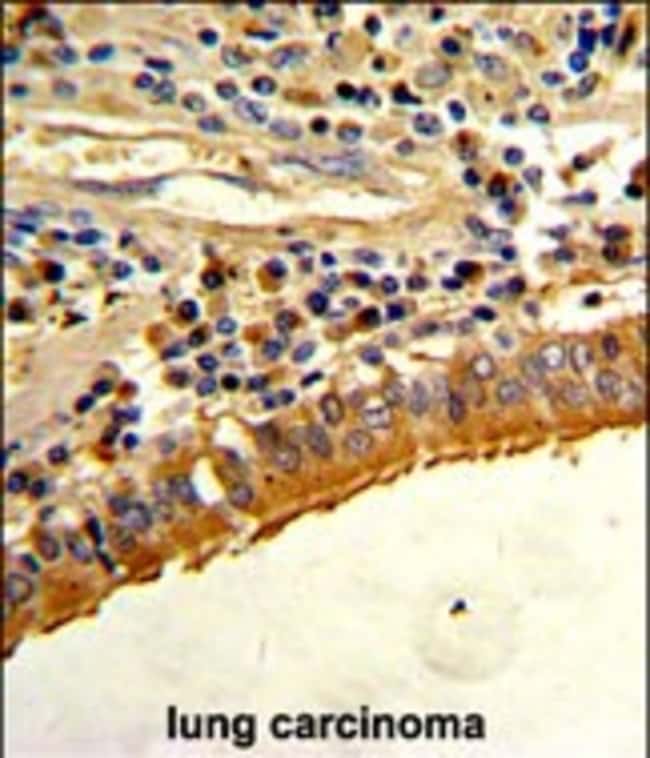 ANTI-SPP1, 0,1mg .