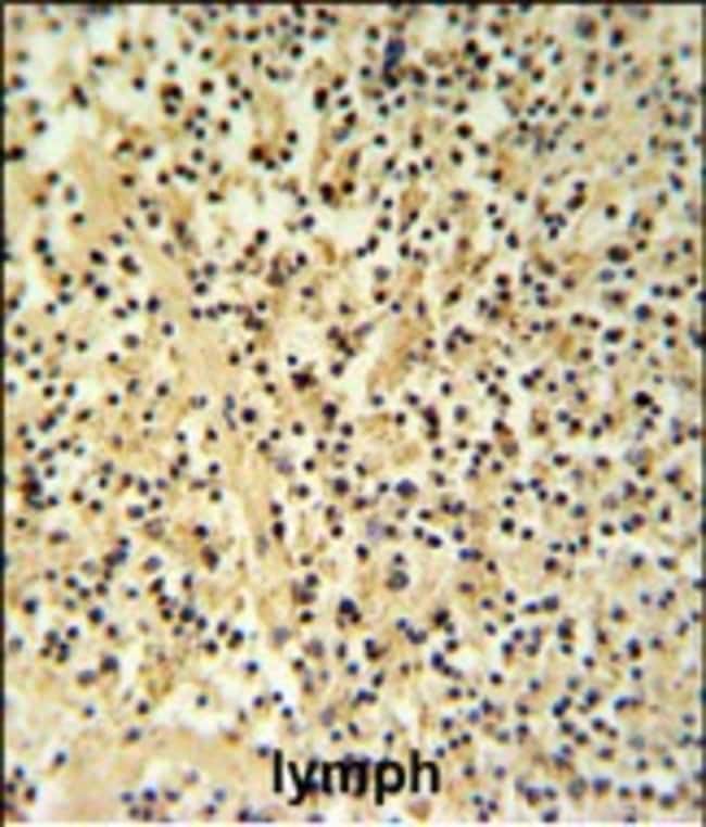 ANTI-GZMB, 0,1 MG