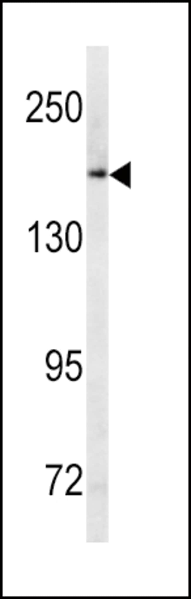 ANTI-ABCC1, 0,1mg .