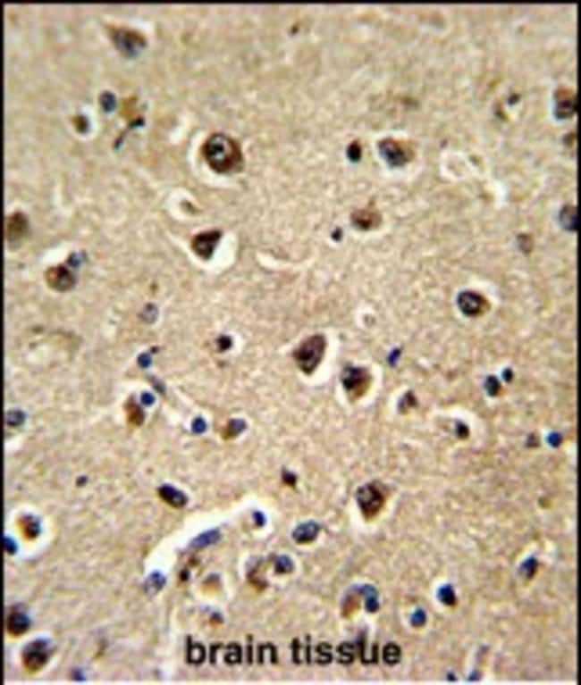 ANTI-BAALC, 0,1 MG