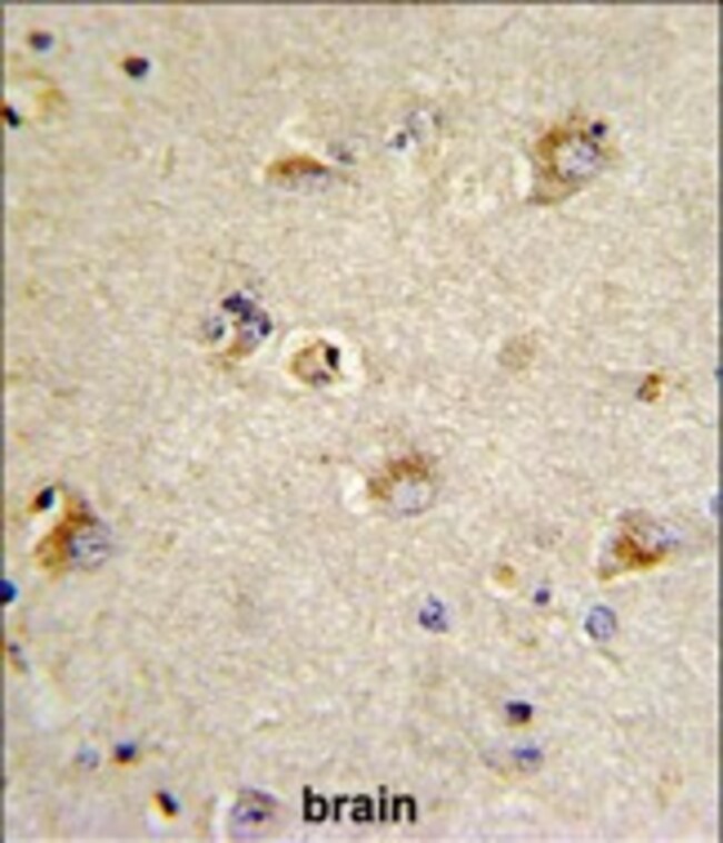 ANTI-CDCA3, 0,1 MG