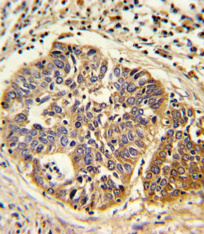 ANTI-HmgCS1, 0,1mg .