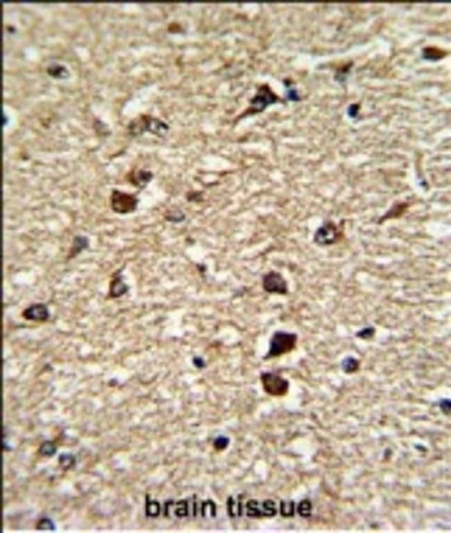 ANTI-XPO1, 0,1 MG