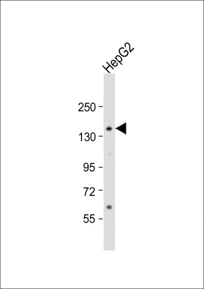 ANTI-AOX1, 0,1 MG