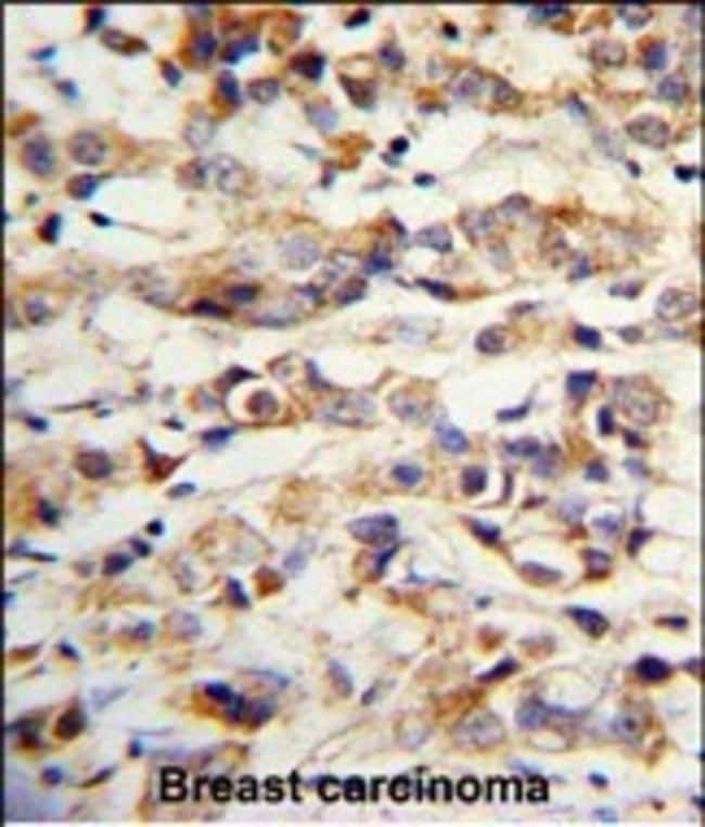 ANTI-KRT14, 0,1mg .