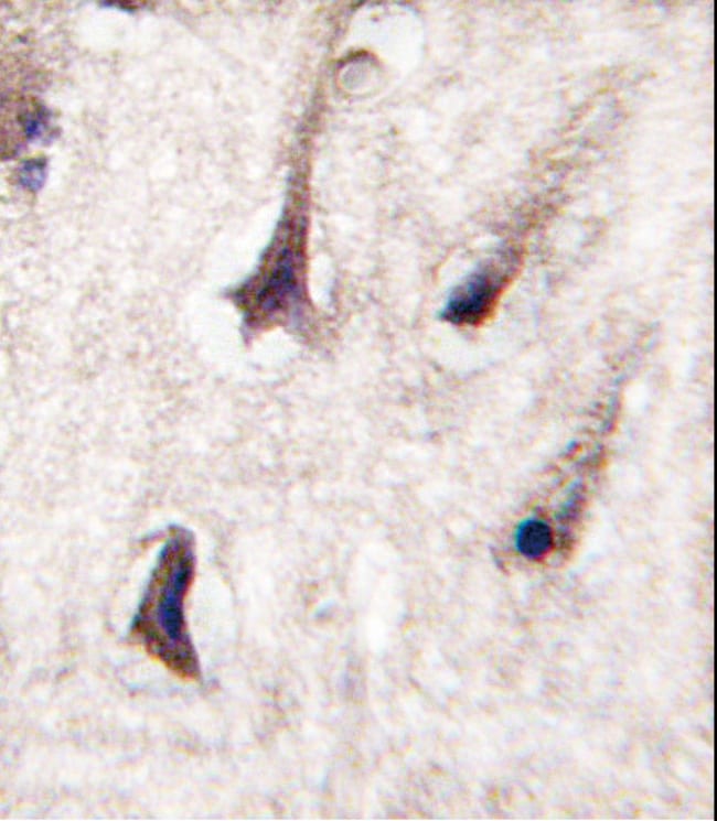 ANTI-PKC BETA2, 0,1 MG