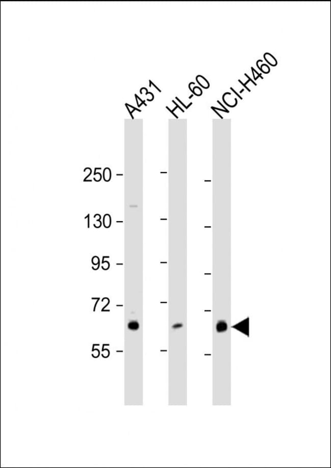 ANTI-PKC ETA, 0,1 MG (RABBIT)