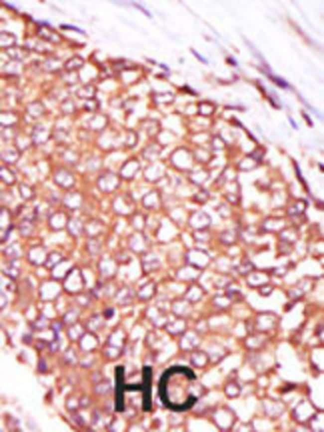 ANTI-PKC THETA, 0,1 MG