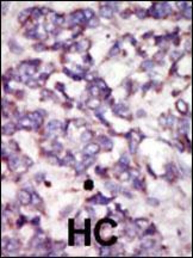 ANTI-PDK2, 0,1 MG