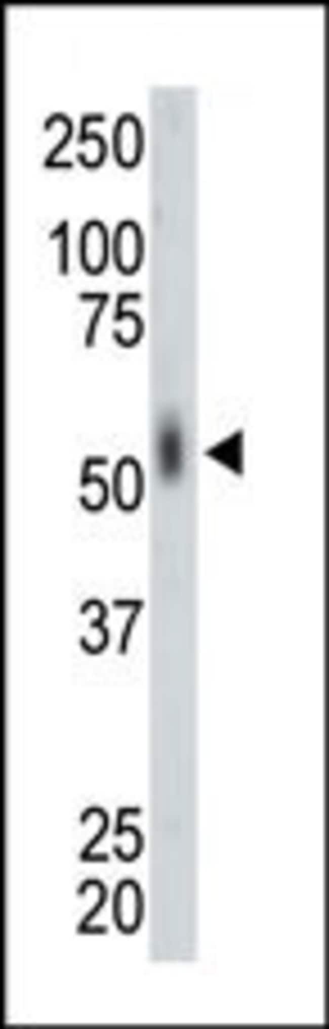 ANTI-MNK2, 0,1mg .