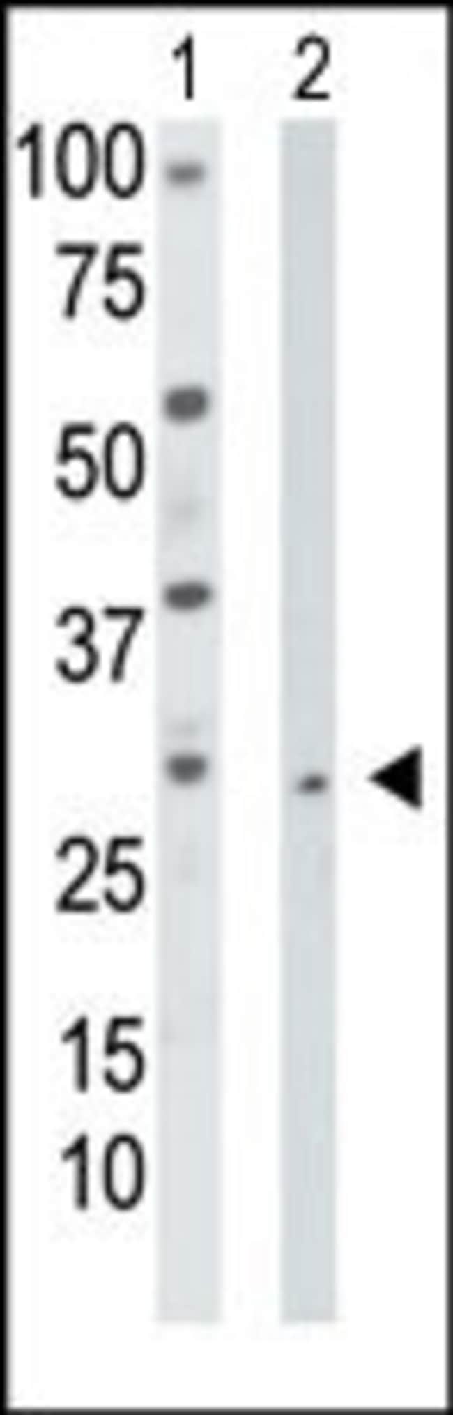 Anti-Thymidine Kinase 2 0.1 mg MG