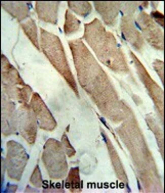 Anti-Creatine Kinase MB 0.1 mg MG