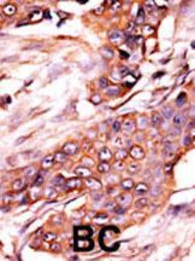Anti-Activin Receptor Type IA 0.1 mg