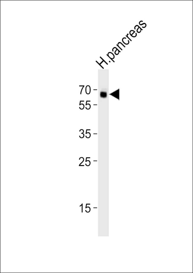 ANTI-ACVR2B, 0,1 MG
