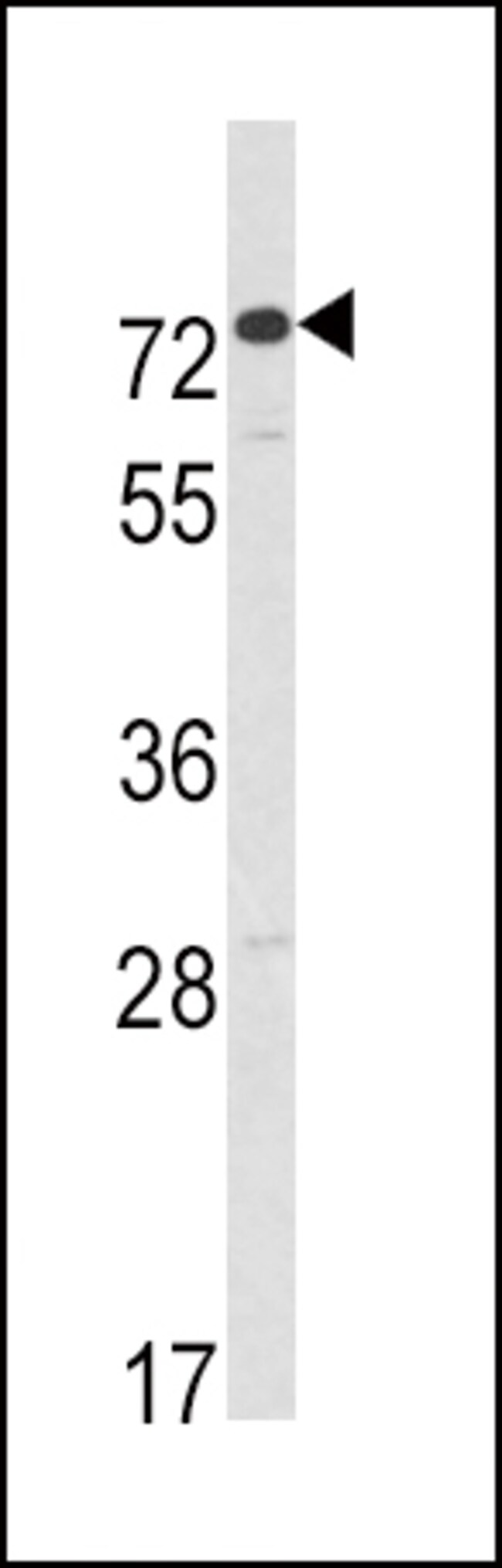 ANTI-AMHR2, 0,1 MG