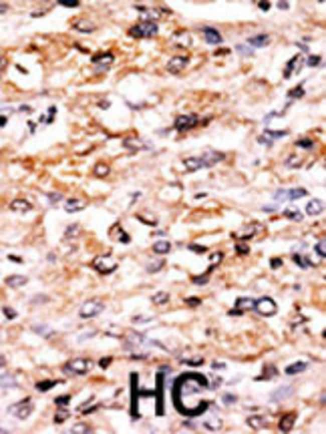 ANTI-GCN2, 0,1 MG
