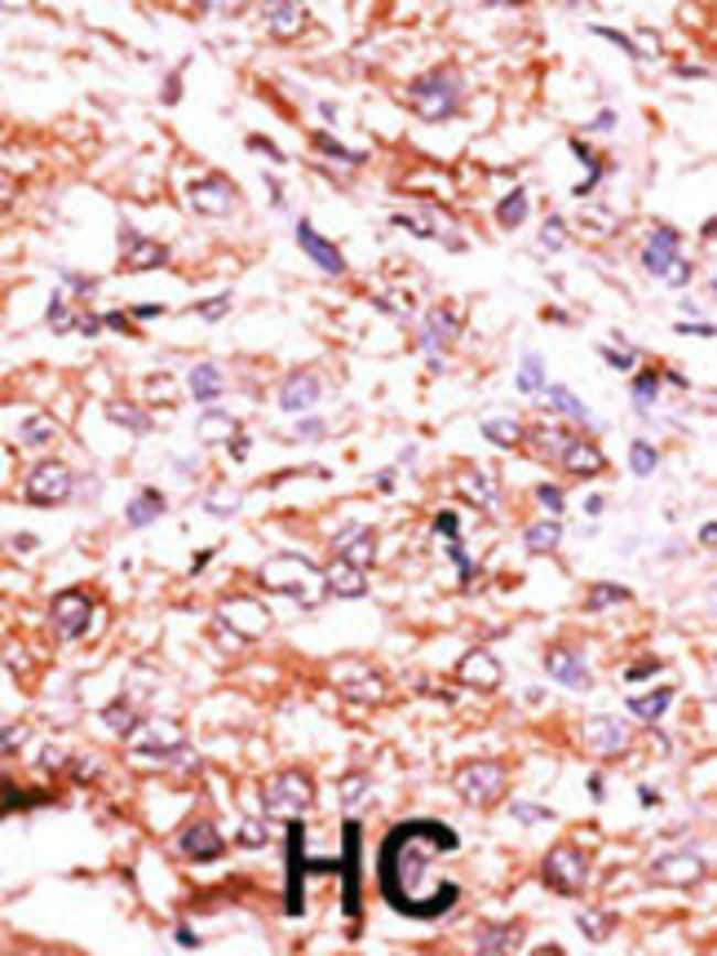 Anti-Guanylyl Cyclase alpha 2 0.1 mg