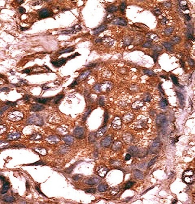 Anti-Guanylyl Cyclase alpha 1 0.1 mg