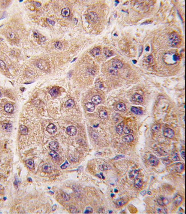 ANTI-PIM3, 0,1mg .