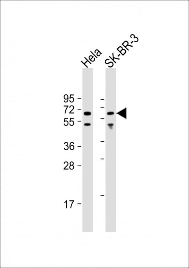 ANTI-AMPK ALPHA 1, 0,1mg .
